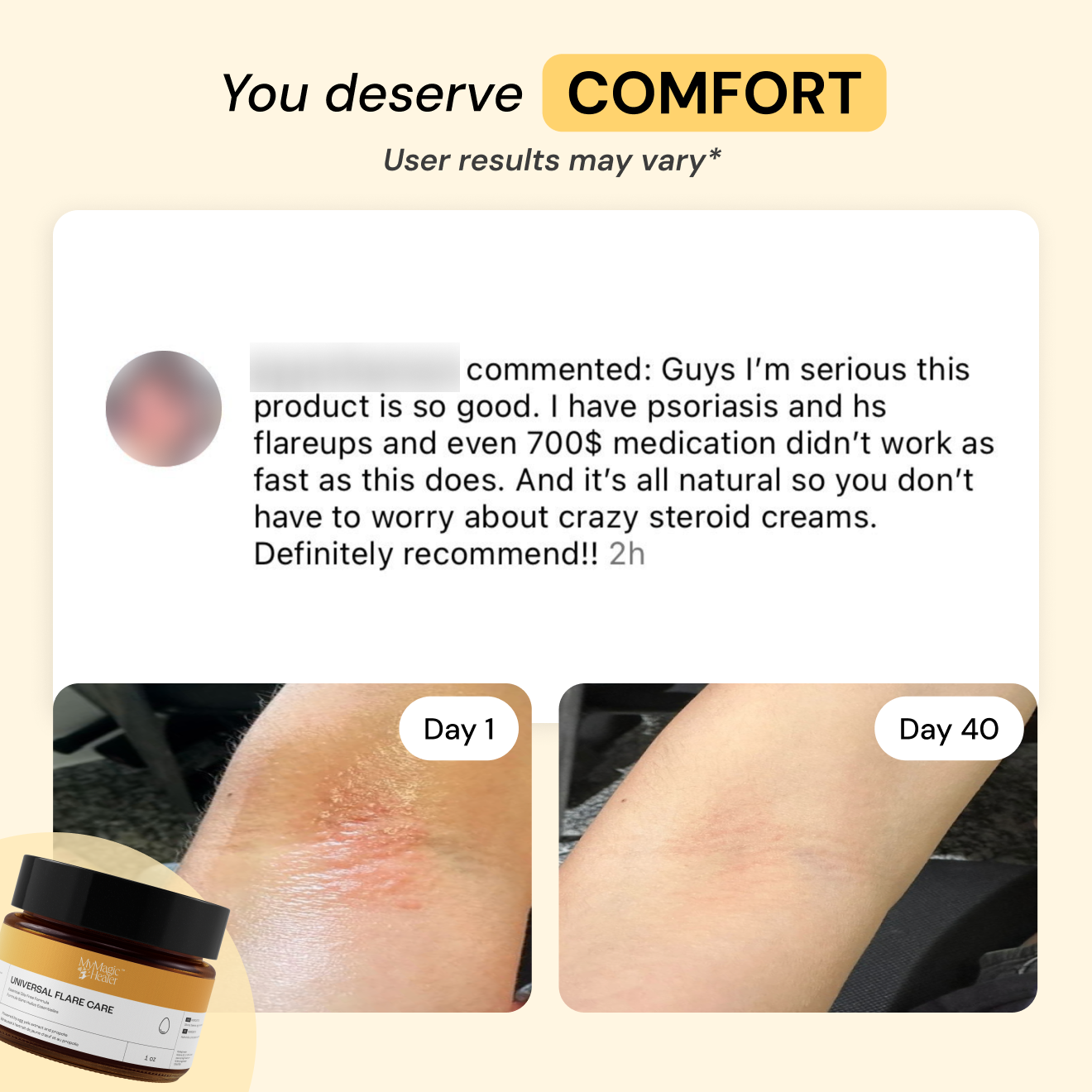 Comfort Flare Care Set