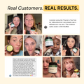 Folliculitis Flare Care Control