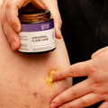 Skin Relief Deal
