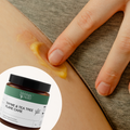 Skin Relief Deal