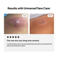 Universal Flare Care