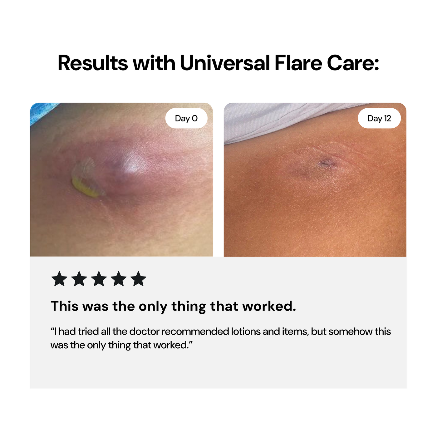 Universal Flare Care