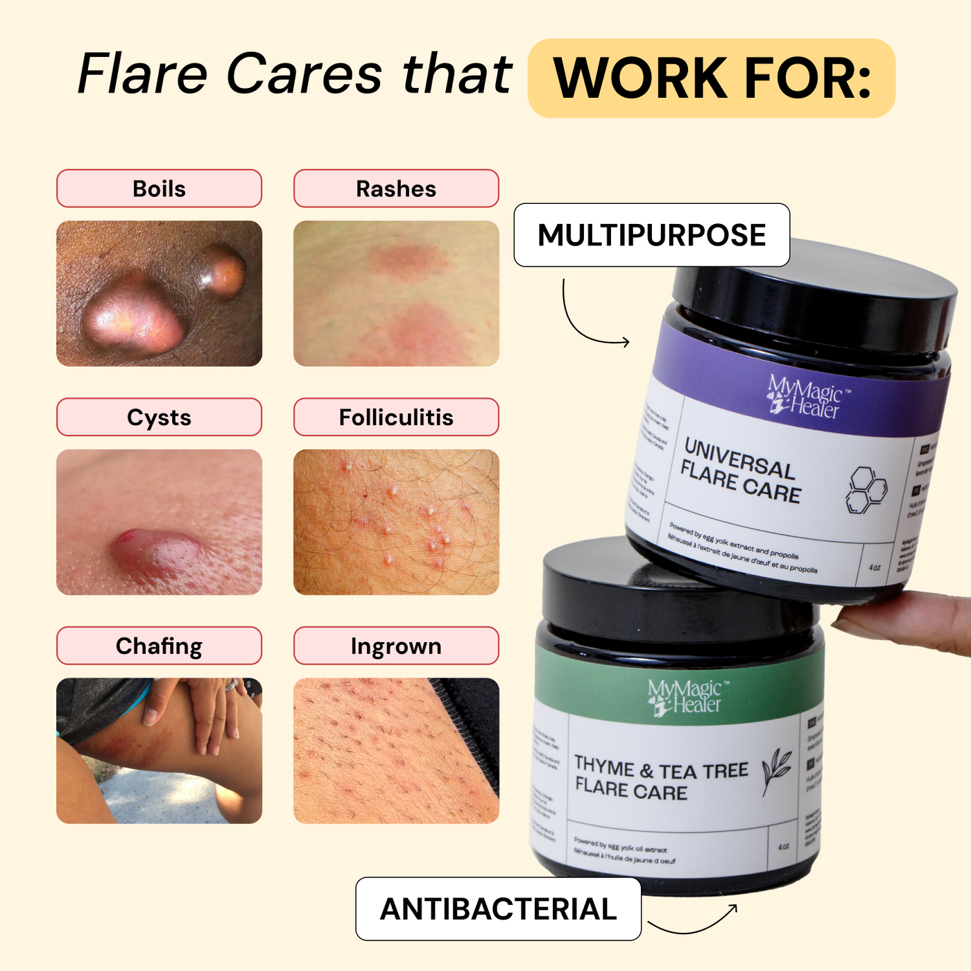Complete Flare Care Duo
