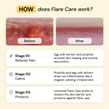 Universal Flare Care | Essential Oil Free