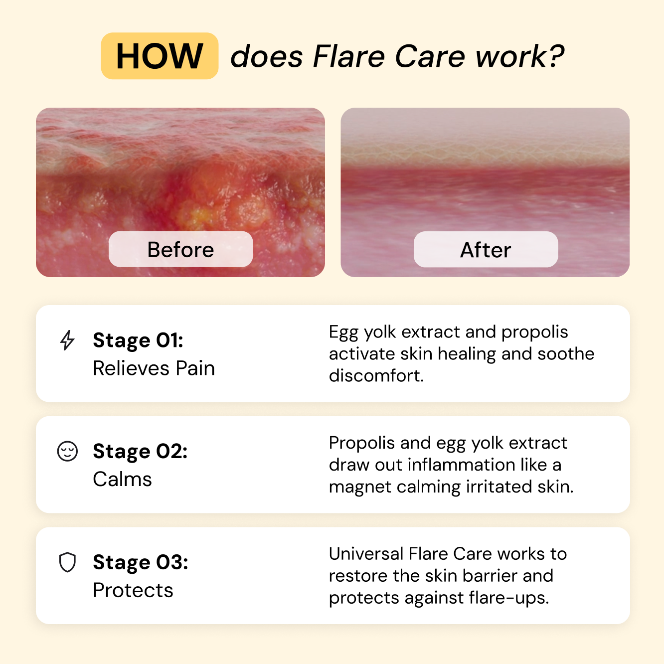 Universal Flare Care | Essential Oil Free