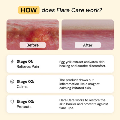 Flare Care Duo | 4oz