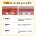 Universal Flare Care