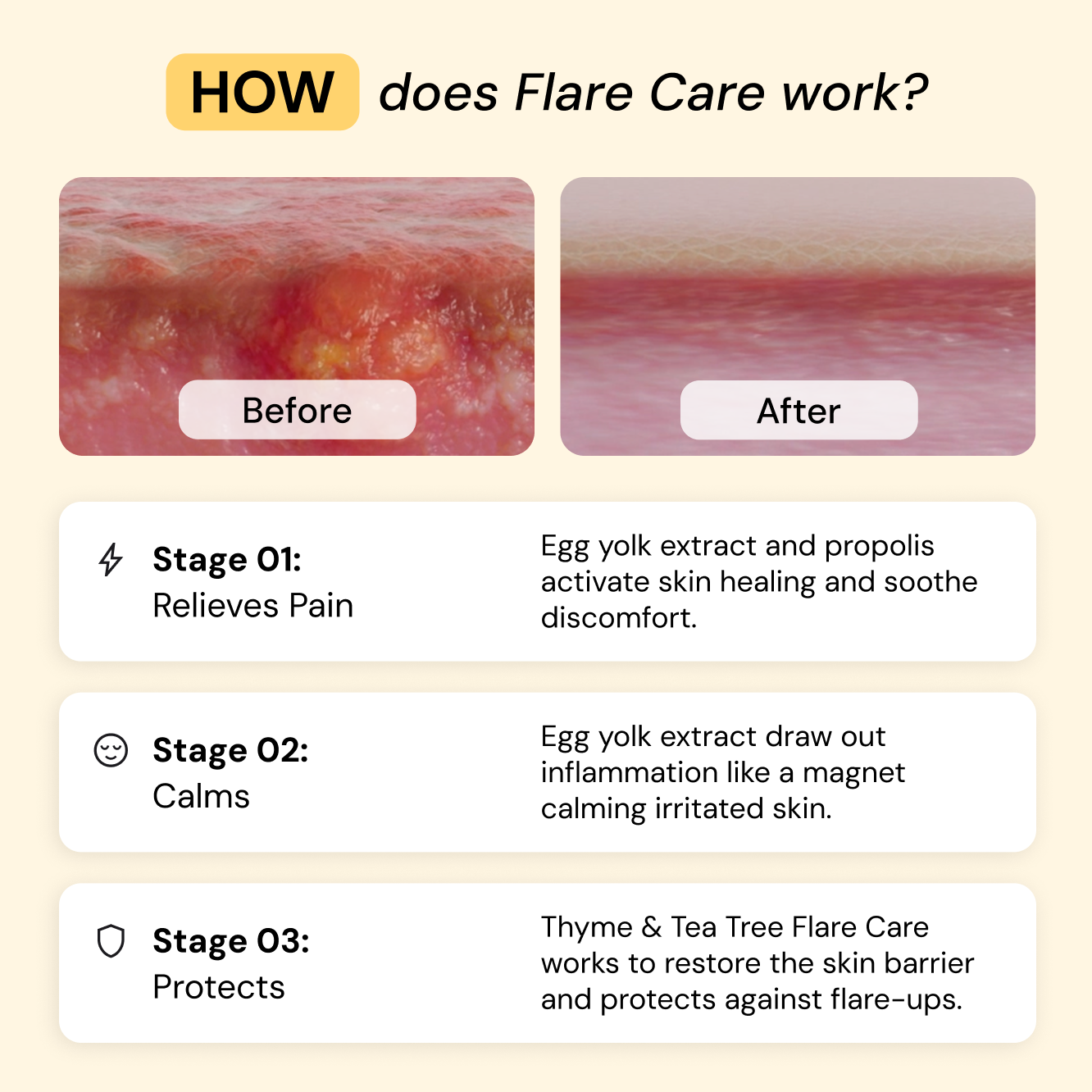 Thyme & Tea Tree Flare Care