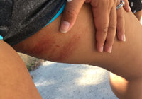CHAFING