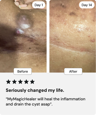 Universal Flare Care