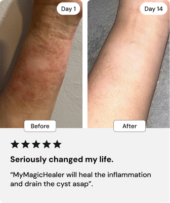 Universal Flare Care