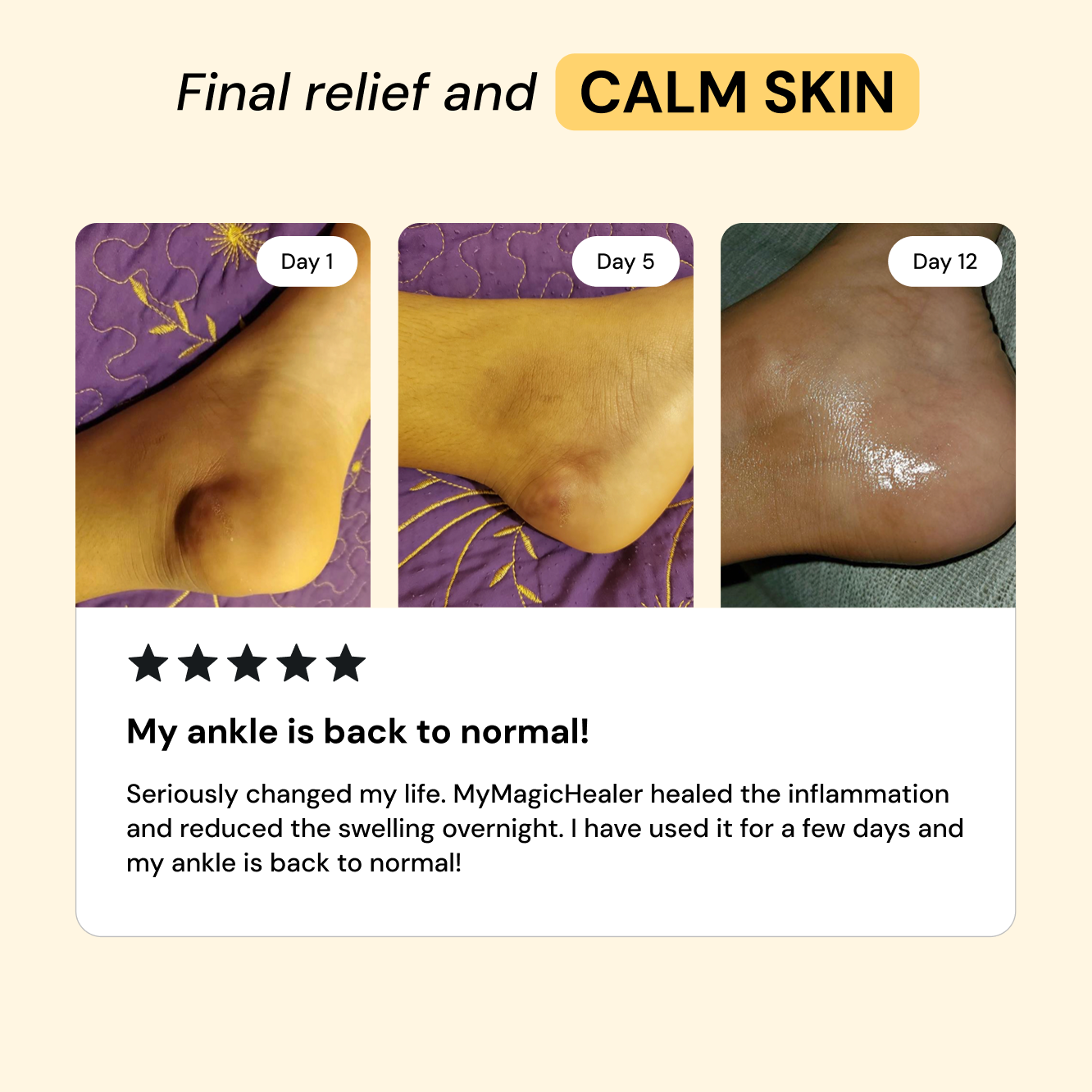 Comfrey & Arnica Relief