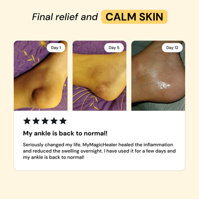 Comfrey & Arnica Relief